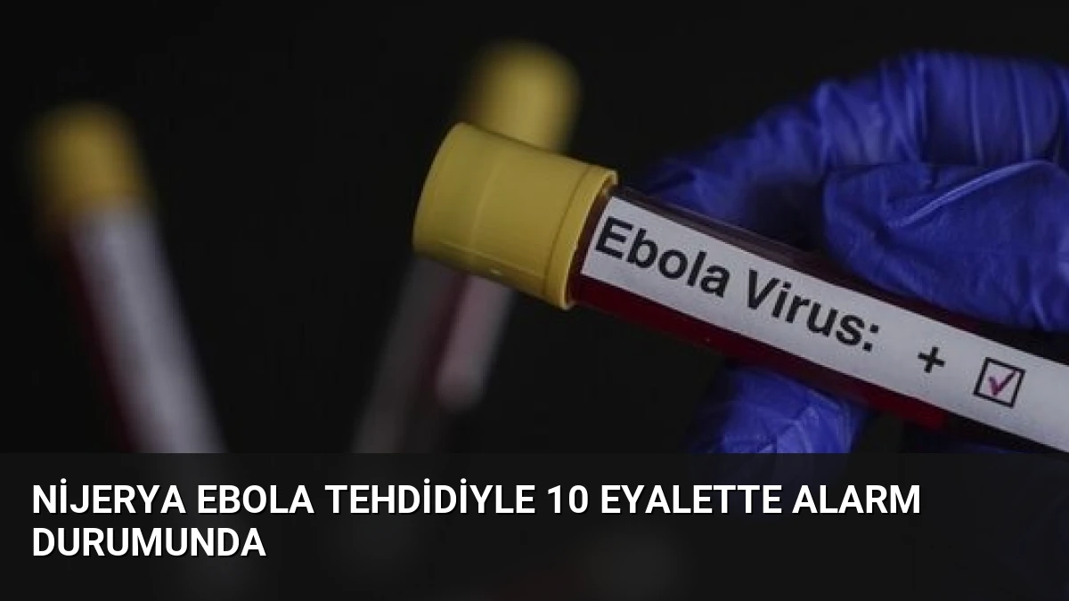Nijerya Ebola Tehdidiyle 10 Eyalette Alarm Durumunda